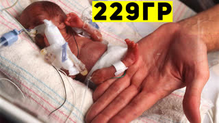Они Одни Такие! 10 Необычных Детей